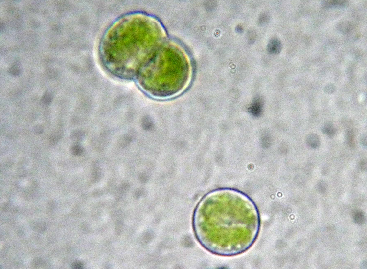 Microalga terrestre: Trebouxia sp